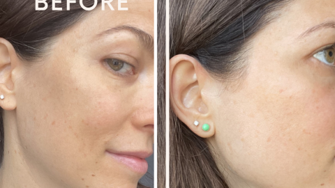 best Benefits of HigherDOSE's Red Light Face Mask Therapy Before and After REview and Discount Code